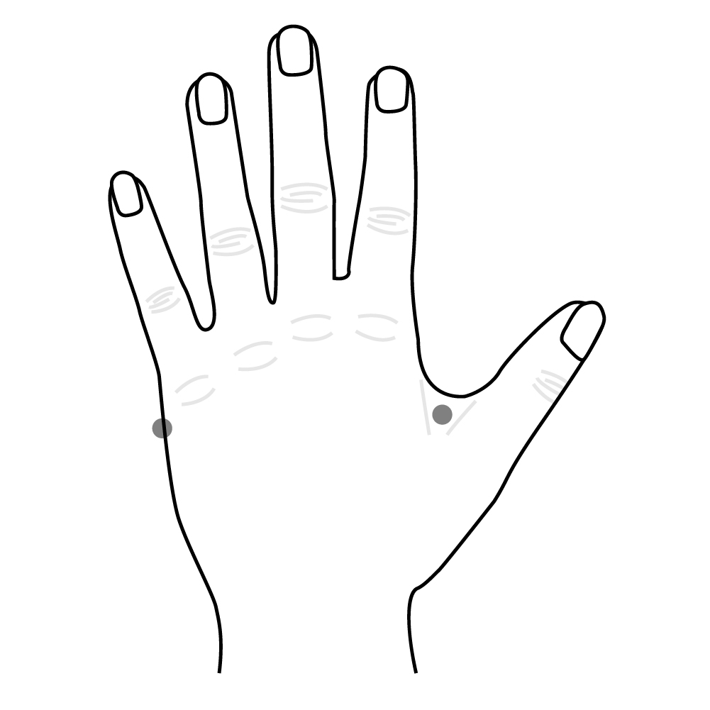 Acupuncture illustration